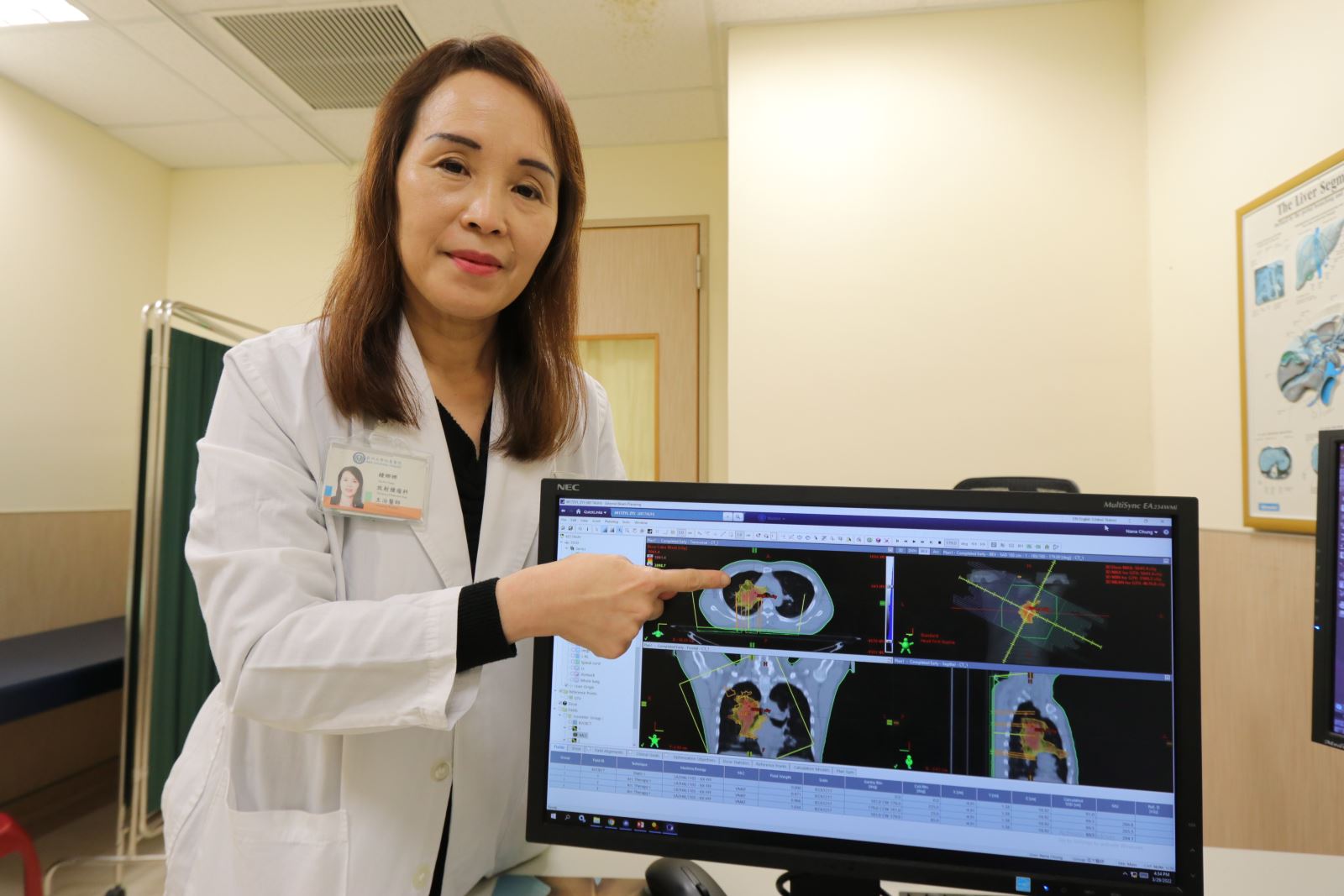 亞洲大學附屬醫院放射腫瘤科主治醫師鍾娜娜表示，治療肺癌必須由多專科團隊合作，為病人量身打造最佳的治療計畫