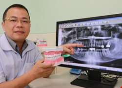 天冷刷牙好崩潰 輕熟女罹重度牙周病 照鏡怨：「牙縫大到像投幣孔」