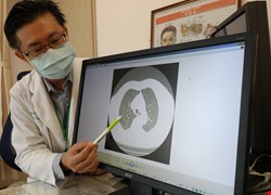 老球痴罹慢性阻塞性肺病高掛球拍 醫鼓勵打網球重拾健康人生
