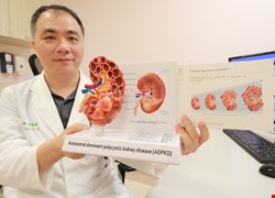 退伍蛙人患多囊腎 「腎臟腫成三倍大」 提早篩檢與用藥預防洗腎