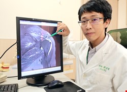 旋轉肌撕裂作祟 老廚師切菜痛如電擊 關節鏡微創手術找回好刀工