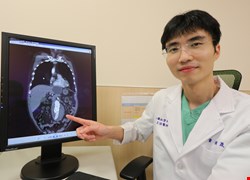 老翁體內藏2顆未爆彈竟無感？微創主動脈覆膜支架手術成功拆彈