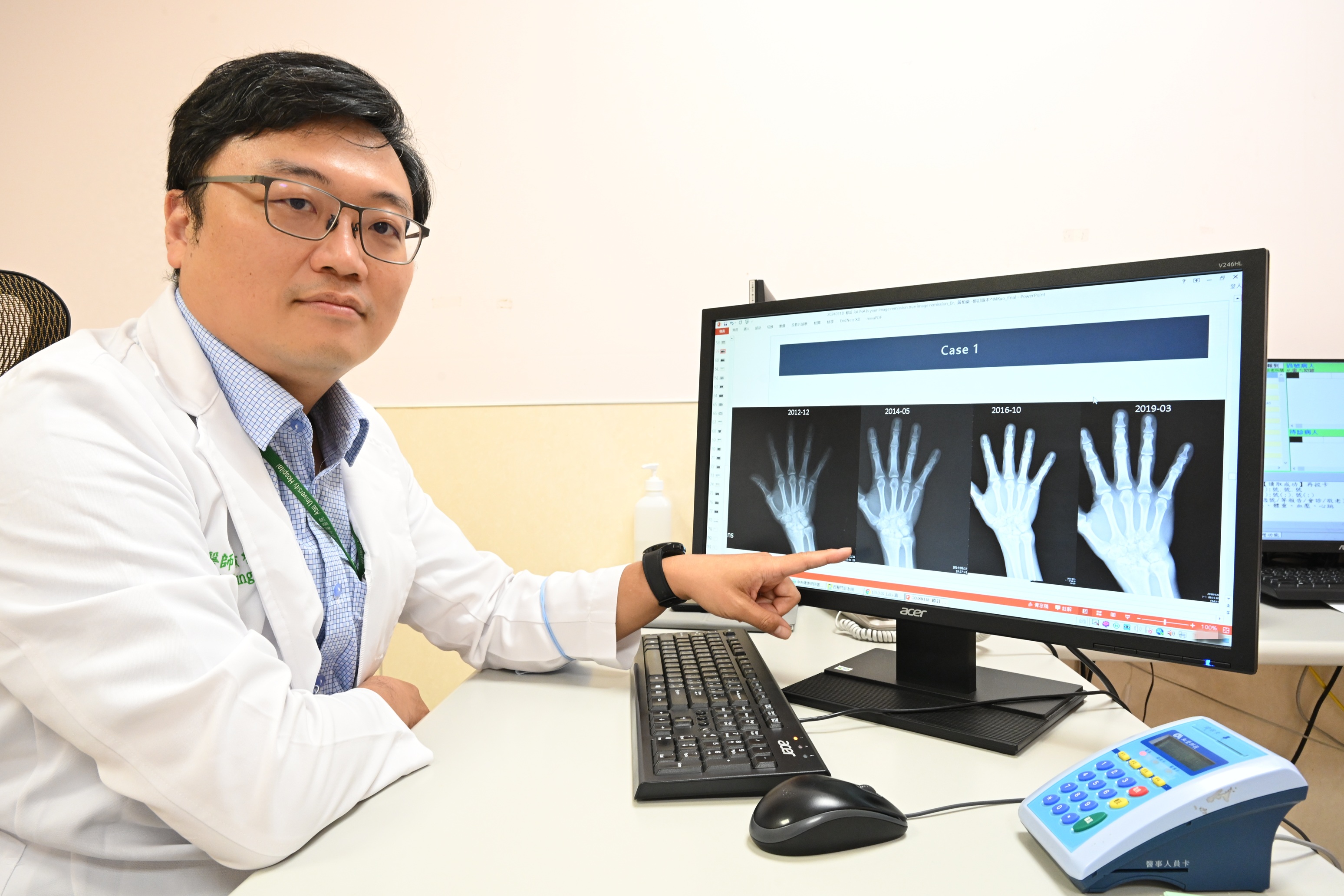 廚師患類風濕關節炎誤認「不會痛就沒事」醫提醒:無聲無息破壞中
