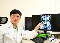 年過40才知姊妹花是兄弟檔？原來是罕見先天性腎上腺增生症惹禍