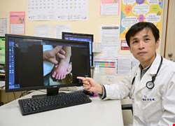 2歲童燒不停 血輪眼、手腳「腫得像麵龜」 原來是川崎症惹的禍