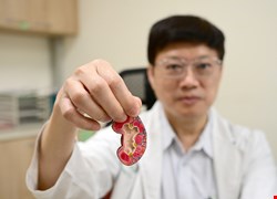 腎臟、心血管雙重保護糖尿病新藥助遠離洗腎風險