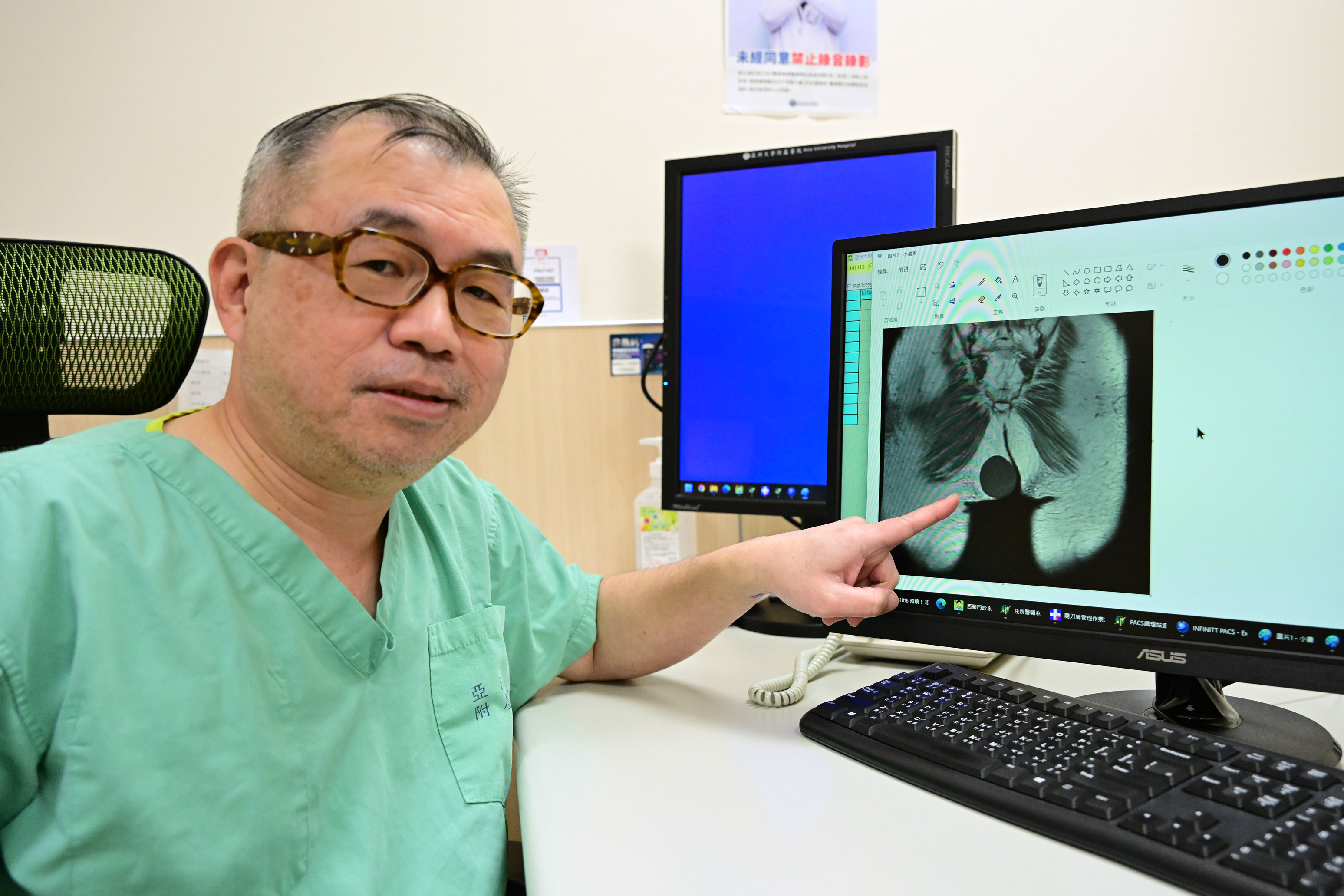 超糗！ 粗獷肉販竟有「蜜桃臀」 原來是巨大粉瘤長在屁股上