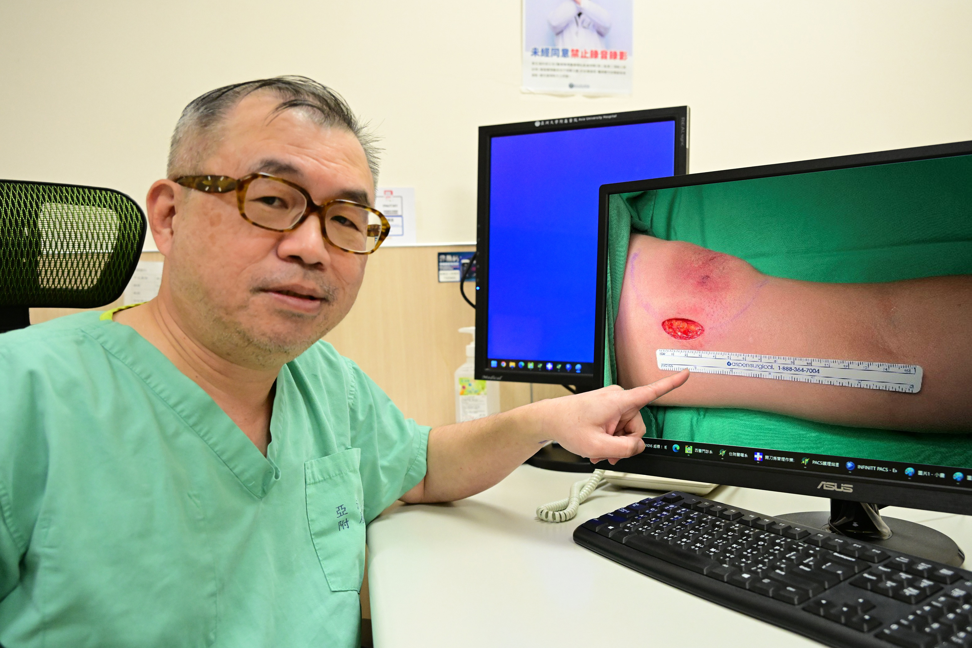 3寶媽忙育兒怨手臂「越練越壯」 竟是脂肪瘤惹禍 微創手術助拆彈