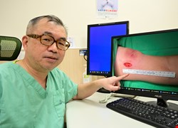 3寶媽忙育兒怨手臂「越練越壯」 竟是脂肪瘤惹禍 微創手術助拆彈