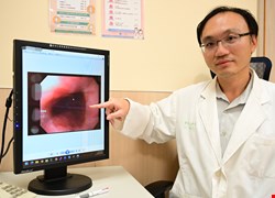 男業務夜夜被胃酸嗆醒竟是睡眠呼吸中止症加劇胃食道逆流症狀