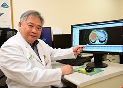 嬤總膽管囊腫疑惡性腫瘤放療取代高風險手術 兼顧病情穩定與生活品質