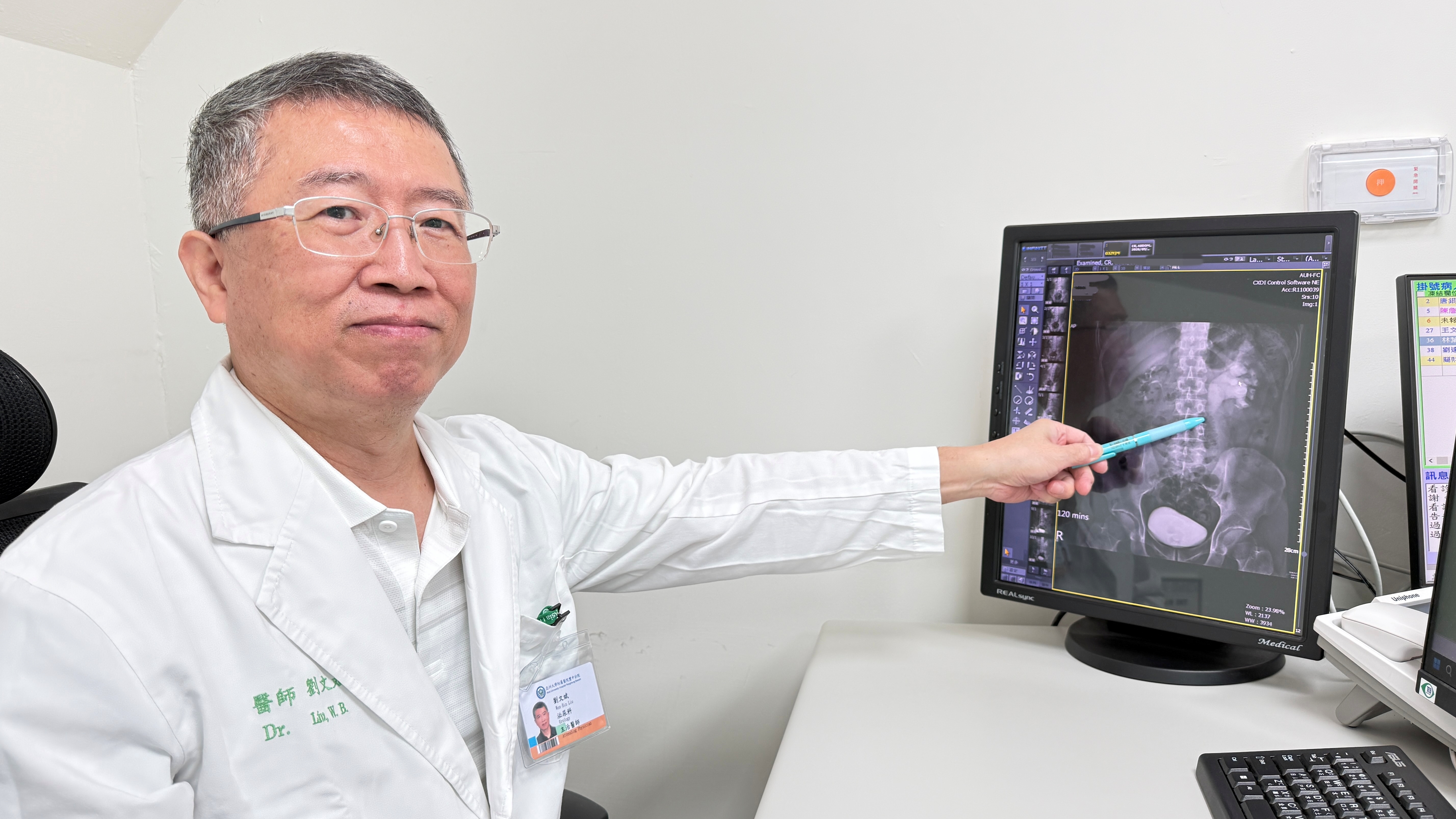 手搖飲當水喝結石引發腎水腫 廚師「痛到腿軟」 震波碎石助復原